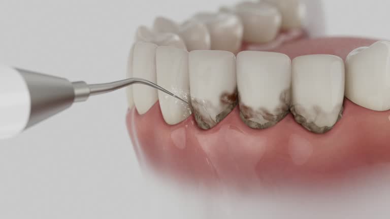 Trusted Teeth Whitening service in Banner Hill, TN - Dentist Open Now